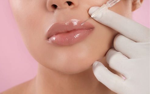 Top Dermal Fillers, HA Fillers & Sculptra