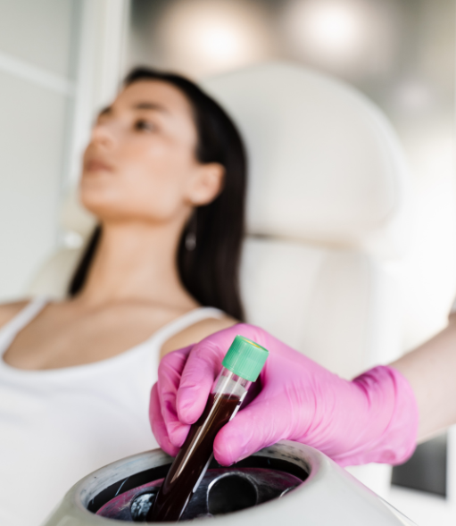 Platelet-Rich Plasma for Acne Scarring