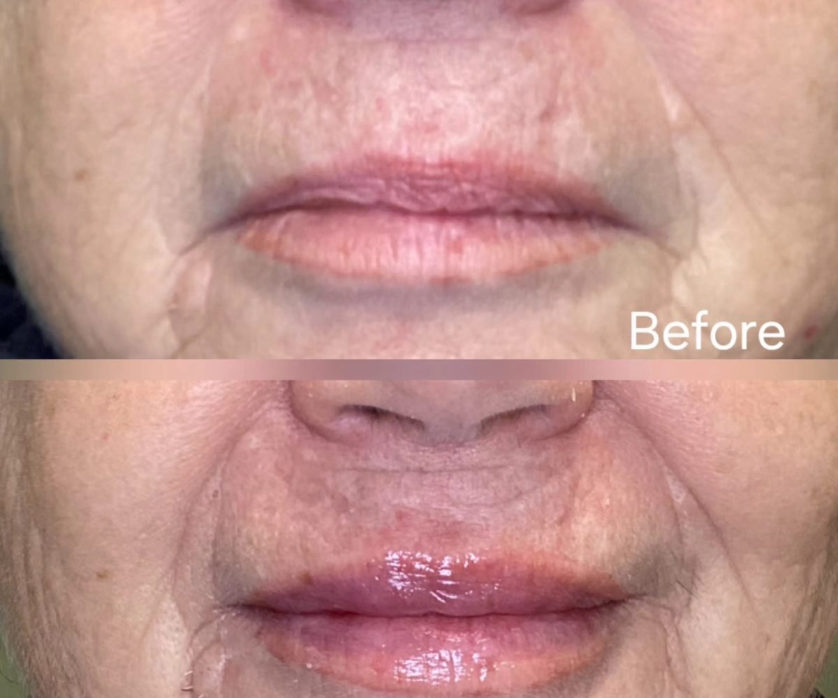 Mature lips